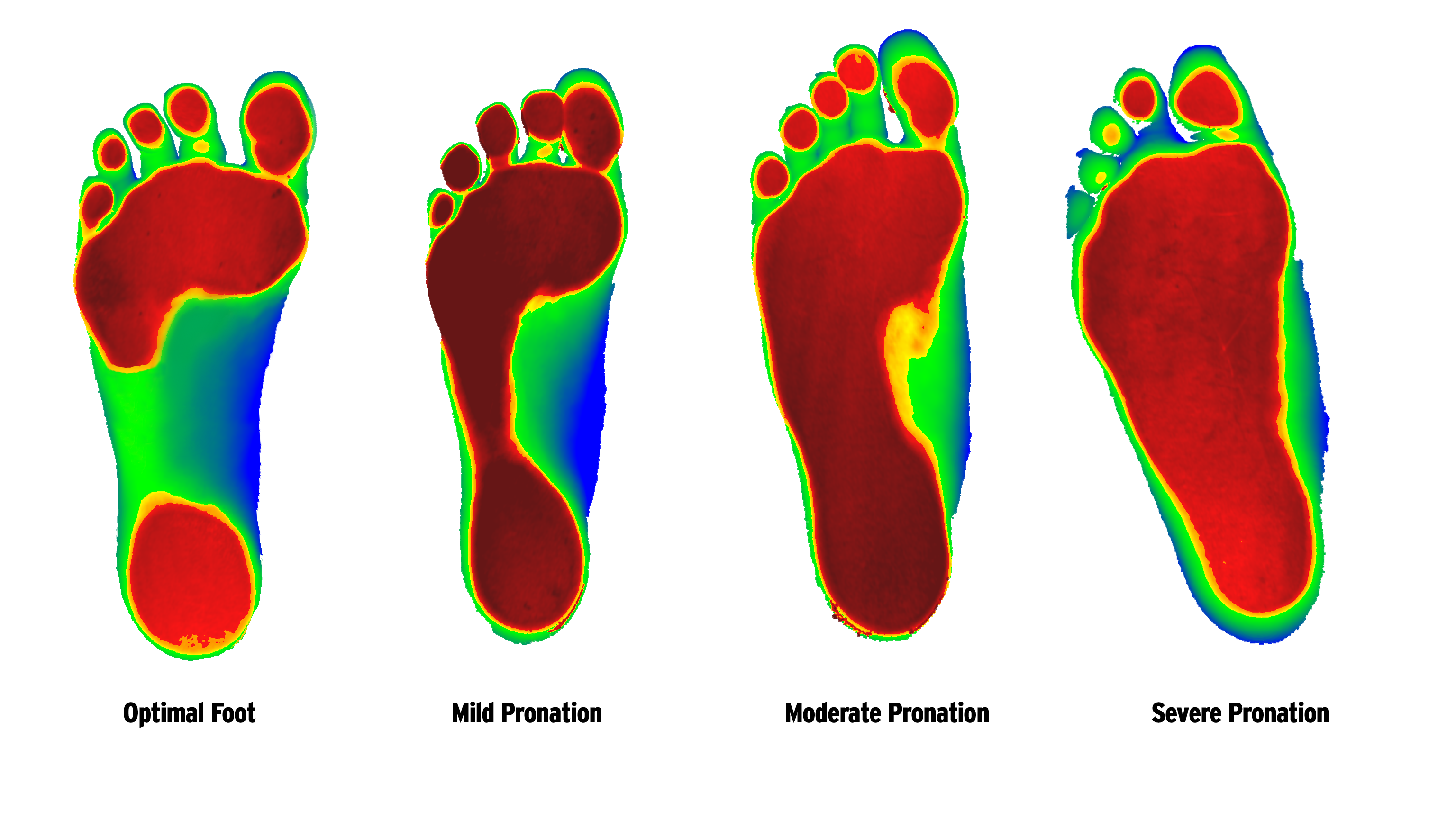 foot levelers orthotic orders
